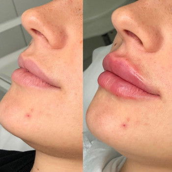 Аида Ханмурзаева, Moscow Фото - 5