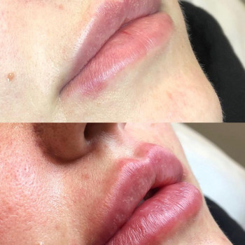 Аида Ханмурзаева, Moscow Фото - 6