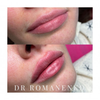 Эллина Романенко, Moscow Фото - 5