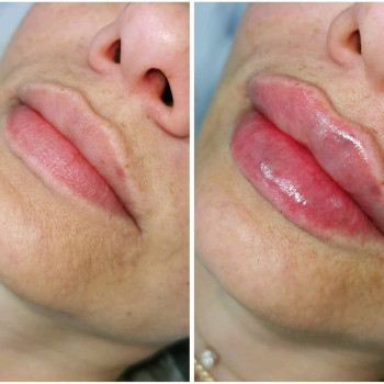 Татьяна Арутюнова, Moscow Фото - 5