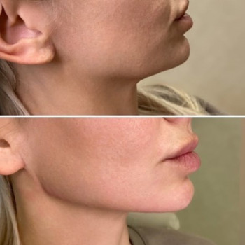 Индира Мухамедьярова, Moscow Фото - 5