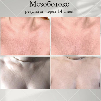 Галина Шушакова, Shchyolkovo Фото - 5