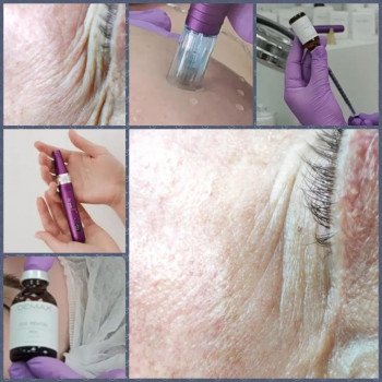 Галина Шушакова, Shchyolkovo Фото - 6