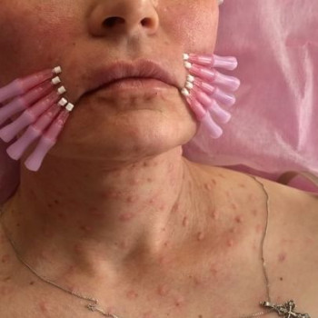 Варсеник , Moscow Фото - 5