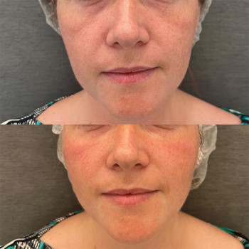 Марианна Байрамукова, Moscow Фото - 5