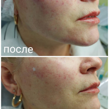 Джамиля Атоева, Moscow Фото - 5