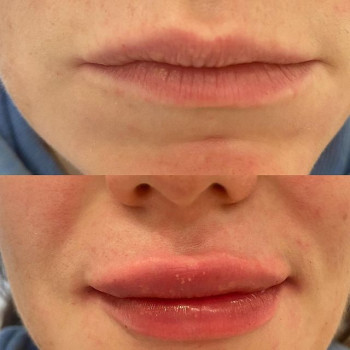 Ирида , Moscow Фото - 5