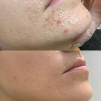 Марина Махсма, Moscow Фото - 5