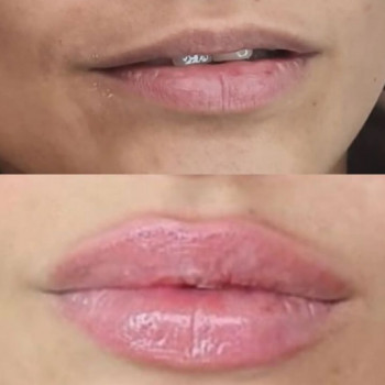 Алена , Moscow Фото - 5