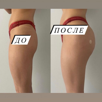 Анна Рубинян, Moscow Фото - 6