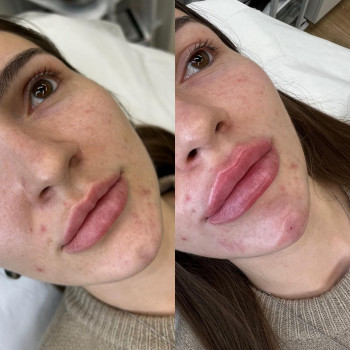 Карина Нурметова, Москва Фото - 5