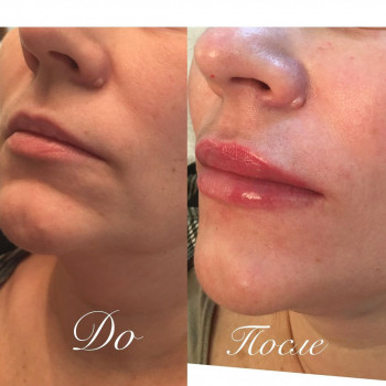 Нина Агафонова, Moscow Фото - 5