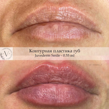 Татьяна Шкурко, Москва Фото - 5