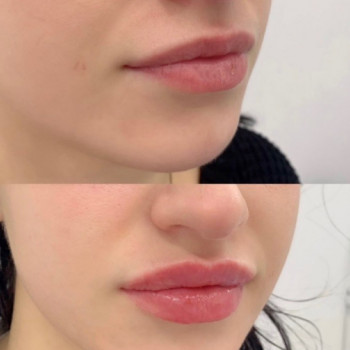 Татьяна Лященко, Москва Фото - 5