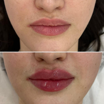 Лусине Мкртчян, Moscow Фото - 5