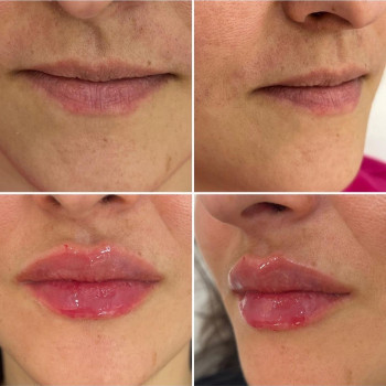 Лусине Мкртчян, Moscow Фото - 6