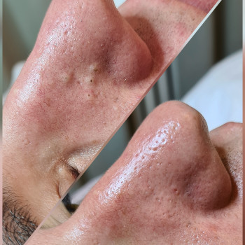 Valeriia Koch, Кладно Фото - 5