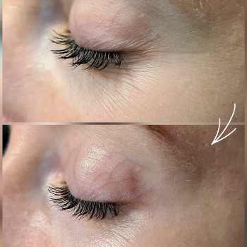 Valeriia Koch, Кладно Фото - 6