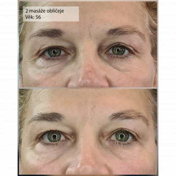 Valeriia Koch, Кладно Фото - 7