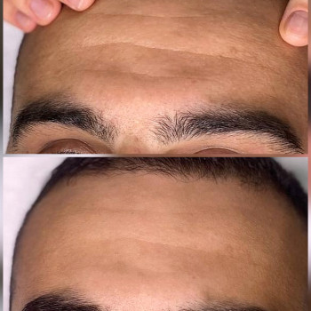 Valeriia Koch, Кладно Фото - 8