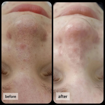 Анна Трегуб, Moscow Фото - 5