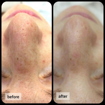 Анна Трегуб, Moscow Фото - 6