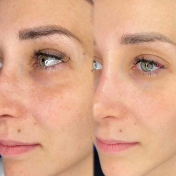 Алена Хлопина, Москва Фото - 5