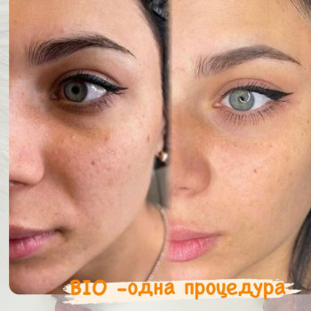 Алена Хлопина, Москва Фото - 6