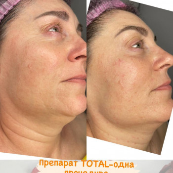 Алена Хлопина, Москва Фото - 7