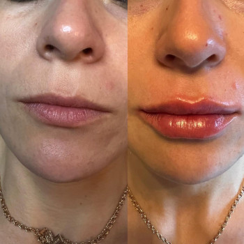 Гузель Нижаметдинова, Moscow Фото - 5