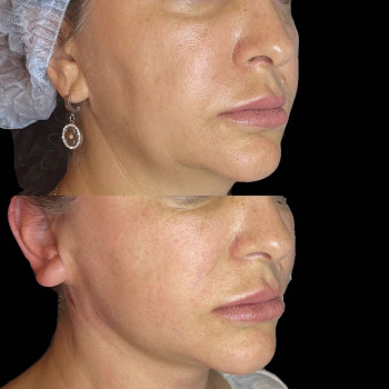 Гузель Нижаметдинова, Moscow Фото - 7