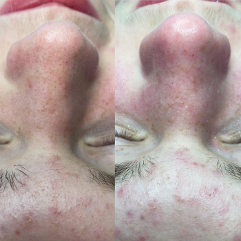 Айгуль Давлетзянова, Moscow Фото - 5