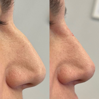 Насиба Девеева, Moscow Фото - 5