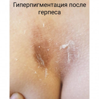 Елена Цой, Moscow Фото - 5