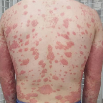 Псориаз-Премиум, Moscow Фото - 6