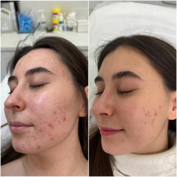 Екатерина Константиновская, Moscow Фото - 5