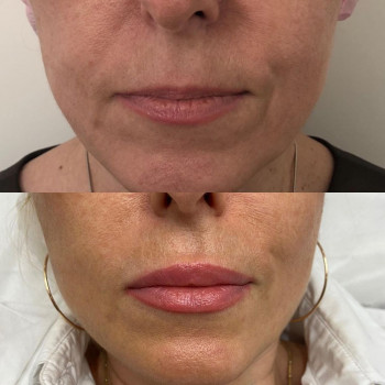 Елена Морозова, Moscow Фото - 5