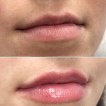 Ольга Соколюк, Moscow Фото - 6