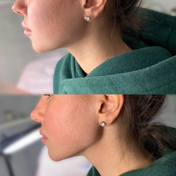 Алиса Кадиева, Moscow Фото - 5