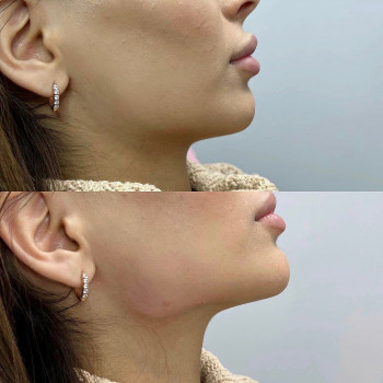 Алиса Кадиева, Moscow Фото - 6