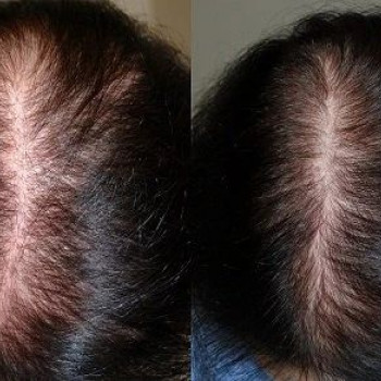 Анна Королева, Moscow Фото - 7