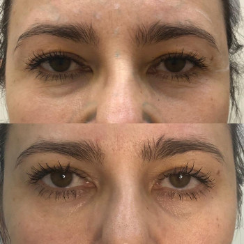 Елена Лебедева, Москва Фото - 5