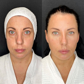 Жанна Житенёва, Moscow Фото - 5