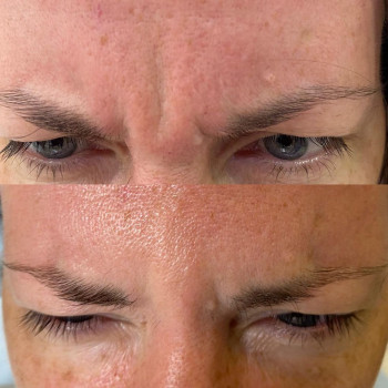 Анна Кучеренко, Moscow Фото - 5