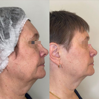 Елена Шеремет, Moscow Фото - 5