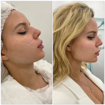 Зарема Джафарова, Moscow Фото - 6