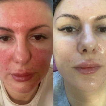 Зинаида Лимонова, Moscow Фото - 5