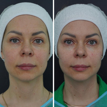 Никита Поярков, Moscow Фото - 6