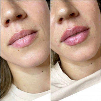 Андрей Дзукаев, Moscow Фото - 5