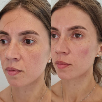 Андрей Дзукаев, Moscow Фото - 6